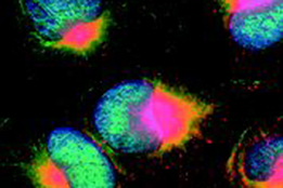 Osteosarcome - division des cellules cancereuses © Fondation ISREC