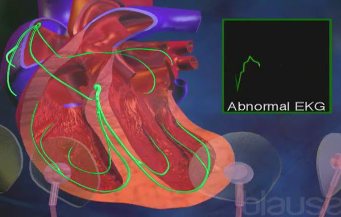 Système de conduction