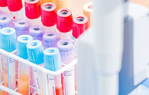 Flow cytometry