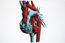 Visualisation du coeur par IRM cardiaque