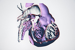 Visualisation du coeur par IRM cardiaque