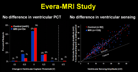 Evera-MRI Study