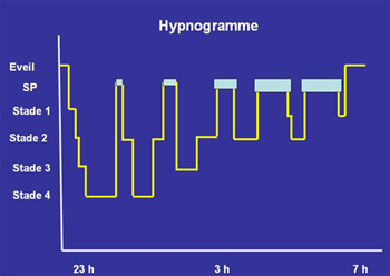 Combien de temps dure un cycle de sommeil ? – Blanc Cerise