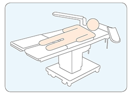 Illustration Pendant l'opération