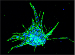 Lymphatic endothelial spheroid